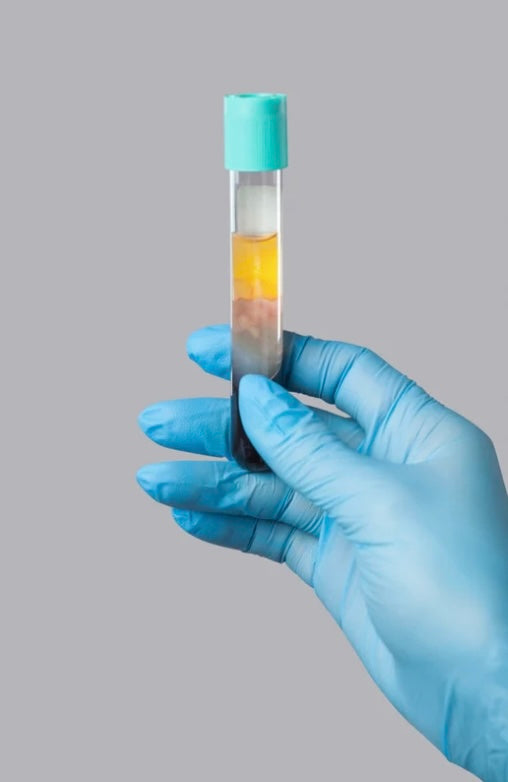 Micro-needling with PRP