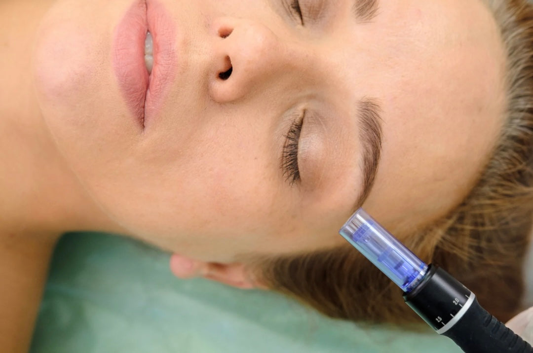 Micro-needling with Booster