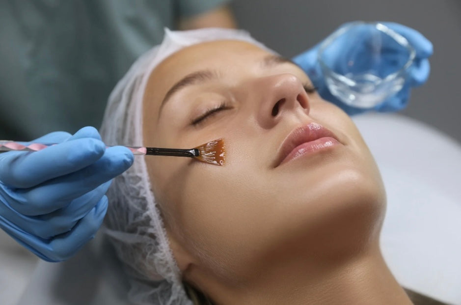 Chemical Peel Facial